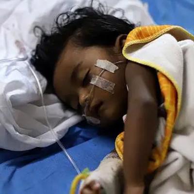 දරුවන් අතර ඩෙංගු, චිකුන්ගන්යා රෝග ඉහළ යාමක්