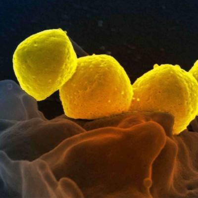 මාංශ භක්ෂක බැක්ටීරියා ආසාදිතයෝ 1,000 පනී